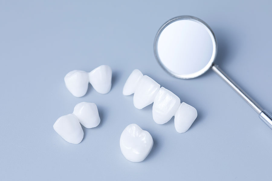 Couronne-dentaire-Dentiste-Dunkerque