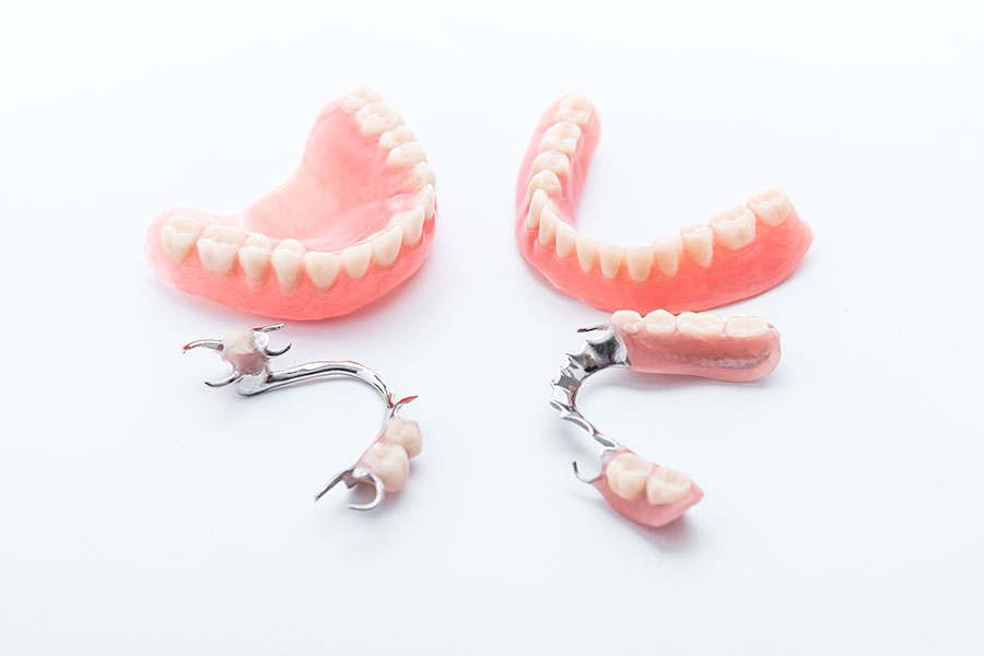 Prothese-amovible-Dentiste-Dunkerque